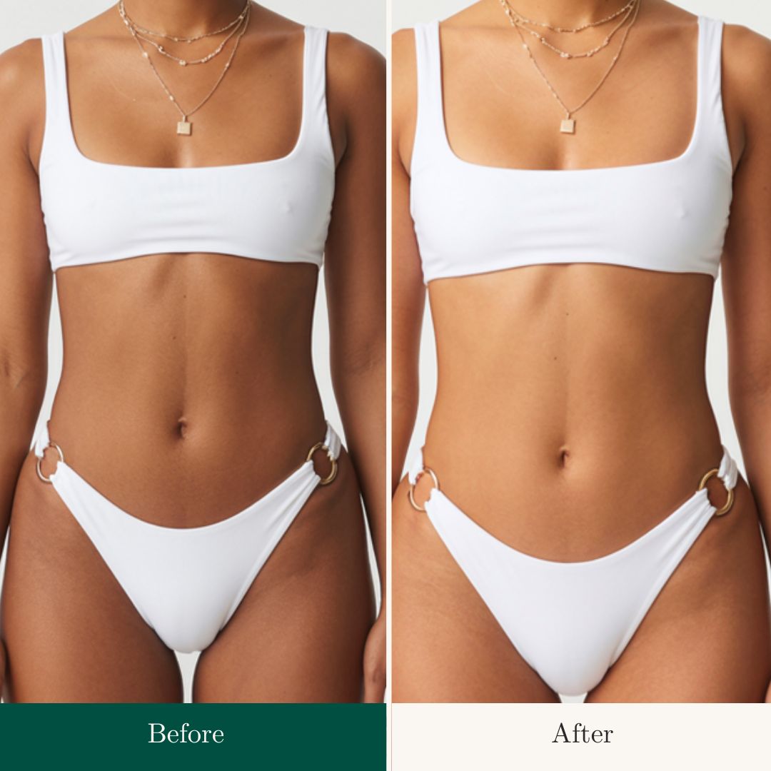 Before After 6